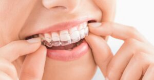 5 Big Invisalign Mistakes Patients Make and How to Avoid Them!