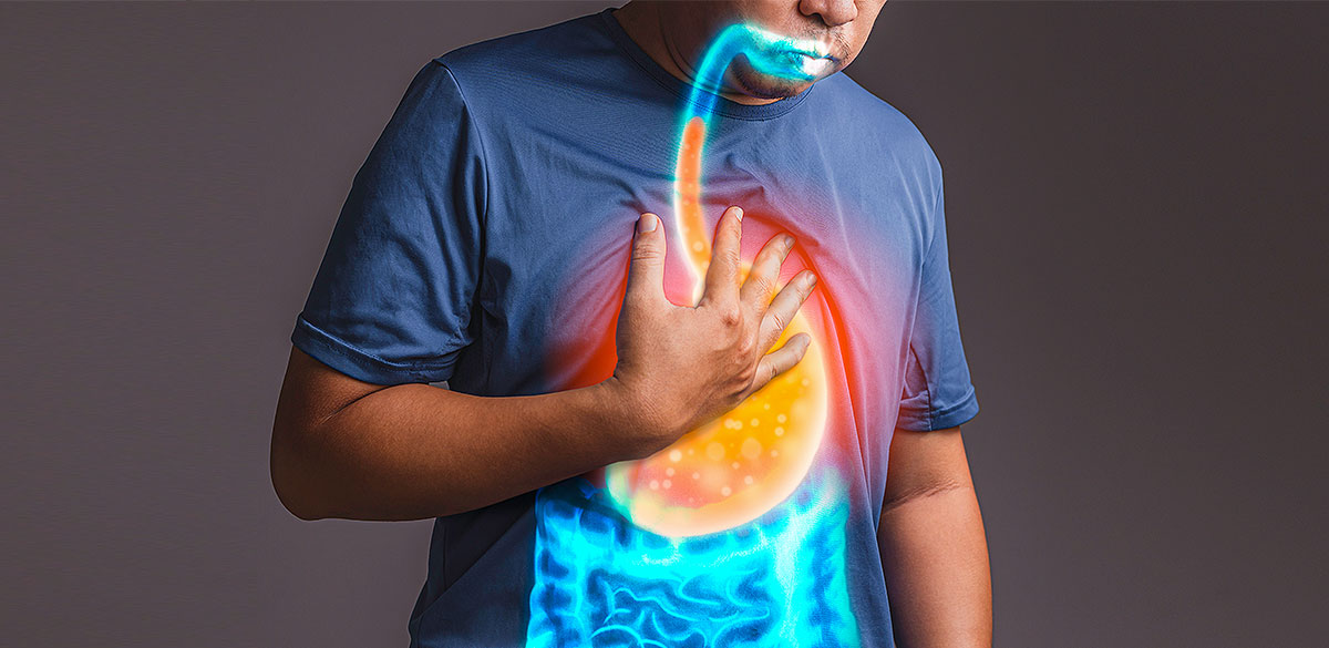 Top Medications That Help Reduce Stomach Acid Quickly