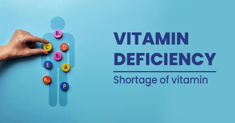 Top 5 Vitamin Deficiency Symptoms You Shouldn’t Ignore!