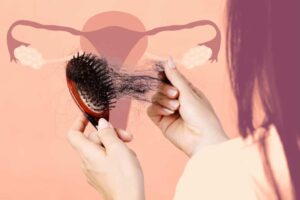 Top 7 Nutritional Solutions for PCOS and Hair Loss!