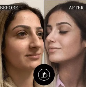 Why the Best Plastic Surgeon in Dubai Is in High Demand