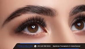 In comparison to London, how much does an eyebrow transplant cost in Turkey?
