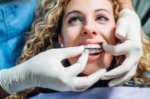 Why Teeth Shift and How Invisalign Helps in Cheltenham