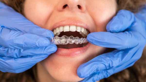 invisalign High Wycombe 