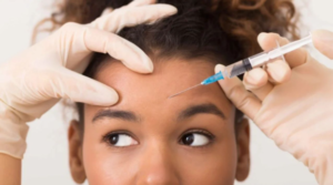 How RF Microneedling in Boynton Beach Can Improve Skin Texture and Tone